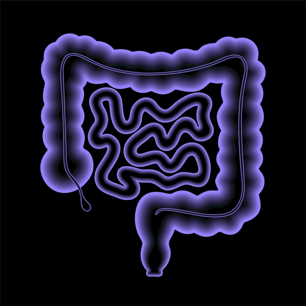 Treating Crohn's Disease with Therapeutic Plasma Exchange