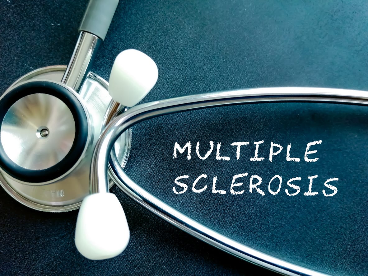 Therapeutic Plasma Exchange for Multiple Sclerosis