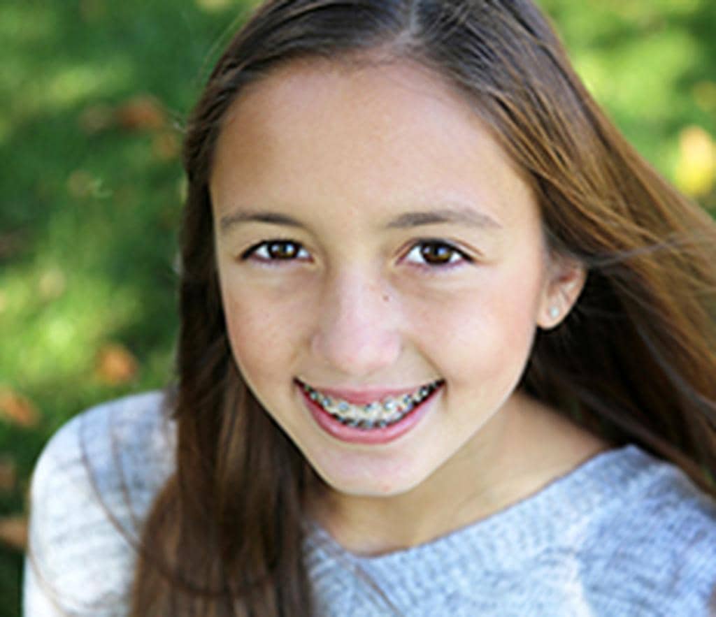 Braces